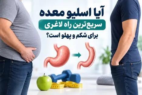 آیا اسلیو معده سریع ترین راه لاغری برای شکم و پهلو است؟